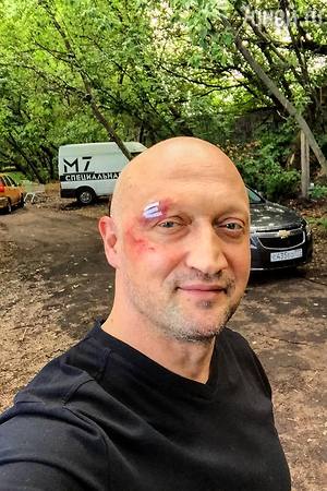 Гоша Куценко травмировался на рок-фестивале