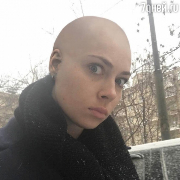 Настасья Самбурская стала лысой из-за подписчиков
