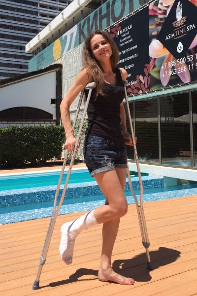 Наталья Лесниковская сломала ногу на «Кинотавре»