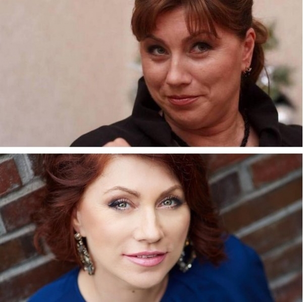 Роза Сябитова показала лицо после очередной операции