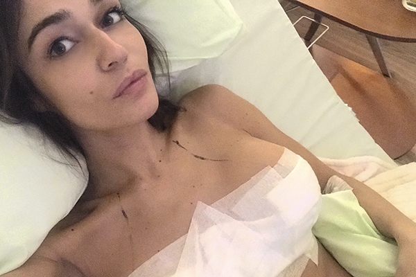 Алена Водонаева уменьшила грудь на два размера. ФОТО