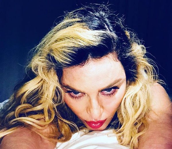 Фанаты пришли в ужас от перетянутого лица Мадонны