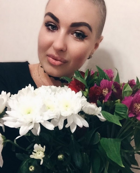 Поборовшая рак Елена Степунина мечтает вернуть прежнюю внешность