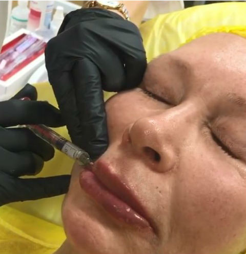 Татьяна Васильева вновь доверила свое тело пластическому хирургу