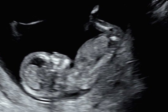 Первые фотографии беременной Никки Беллы на прогулке, после подтверждения слухов об этом