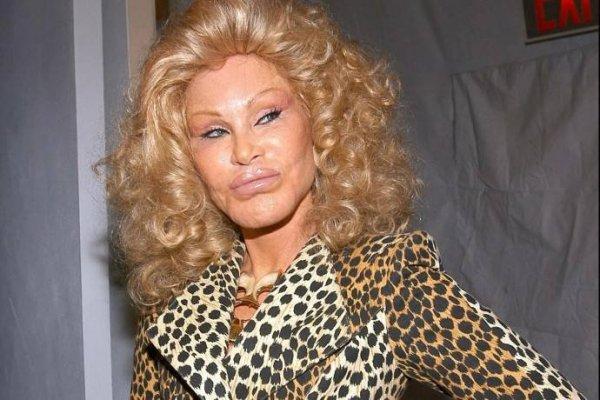"A terrible victim of plastic surgery": what billionaire Jocelyn Wildenstein looks like now